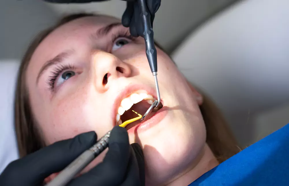 Caries Treatment Berlin